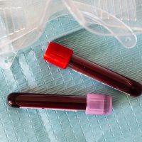 CMP (comprehensive metabolic panel)